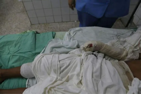 quemados.17_LP914594_MG80556261