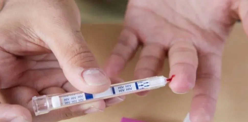 HIV test enfermedades de transmisión sexual