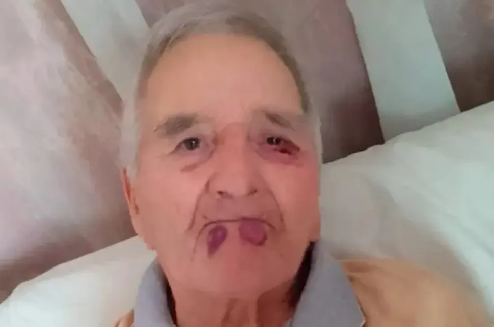 Abuelo golpeado