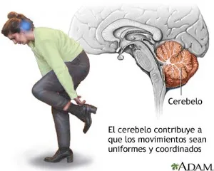 cerebelo