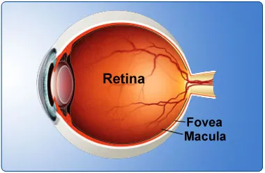 Retina-about
