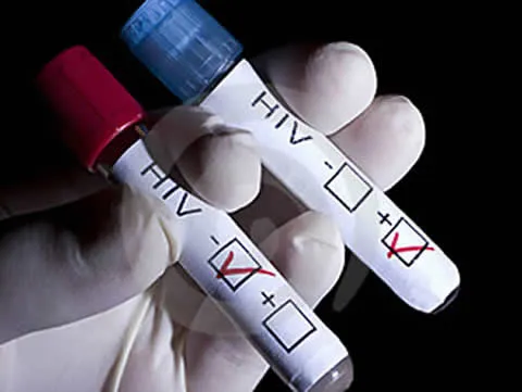 VIH