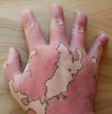 mano