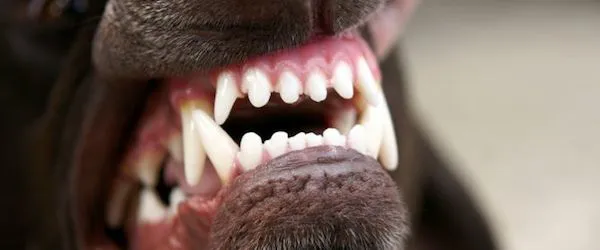 Dentadura