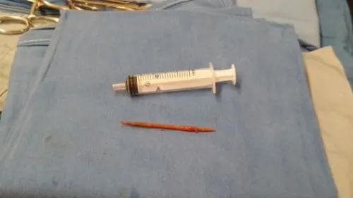 Escarbadientes-encontrado-medio-corazon_CLAIMA20151015_0104_39