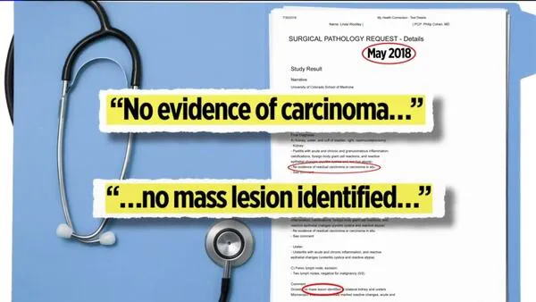 Los reportes mÃ©dicos realizados aseguraron que no tenÃ­a cÃ¡ncer (Foto: Especial FOX)