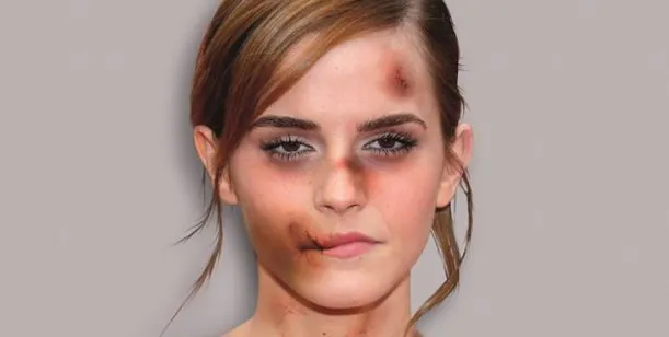 emma-watson1
