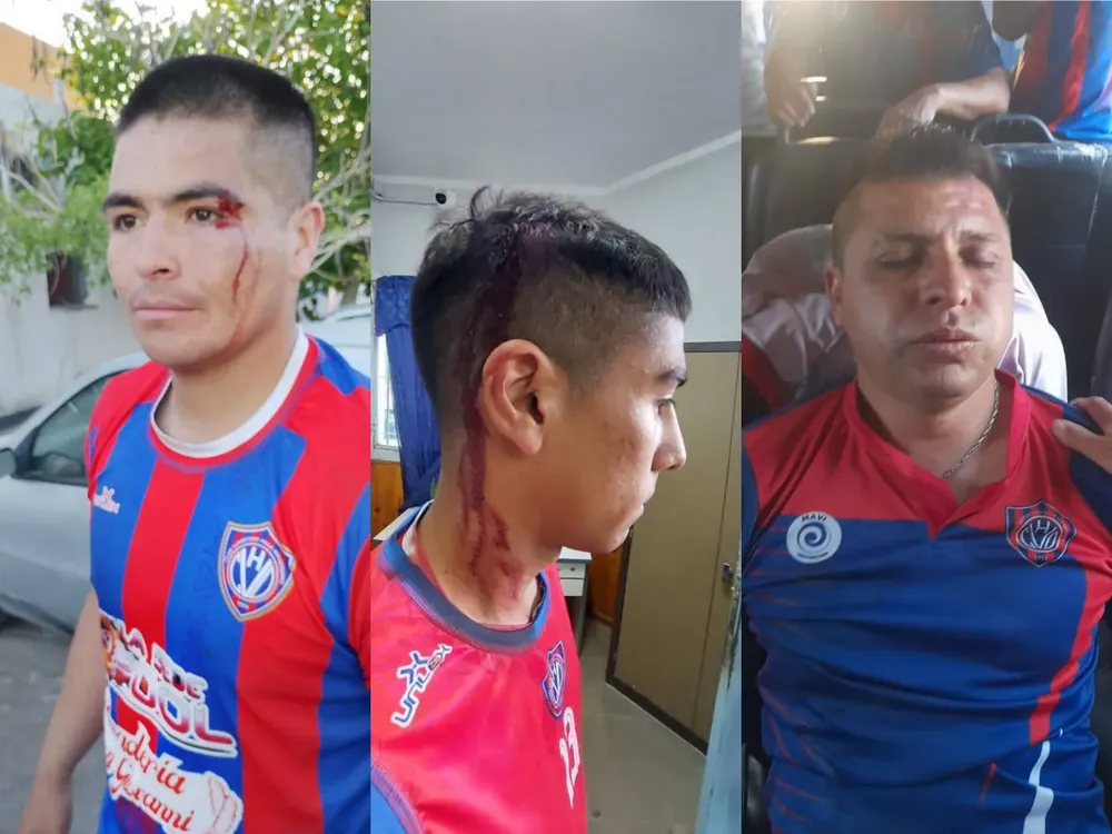 photogrid.photocollagemaker.photoeditor.squarepic_20251117887858