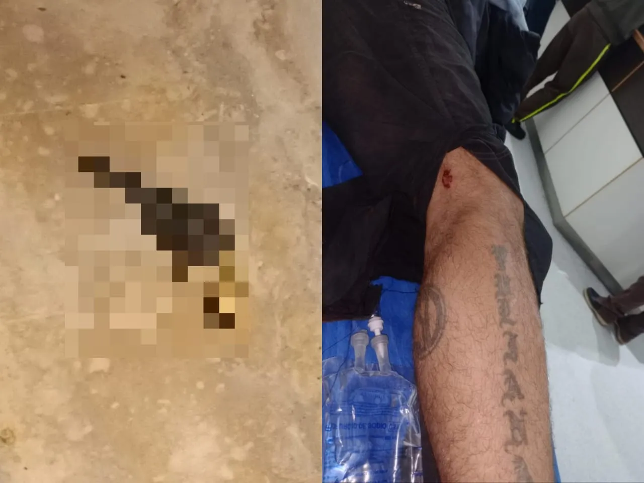 herido bala
