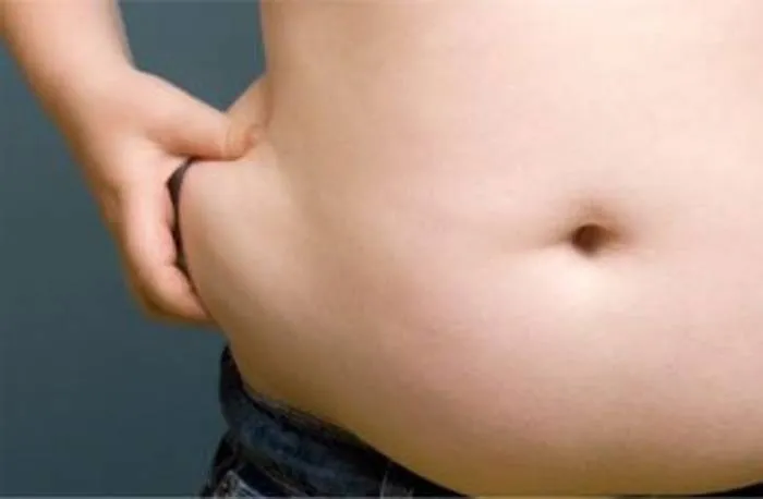 obesidad