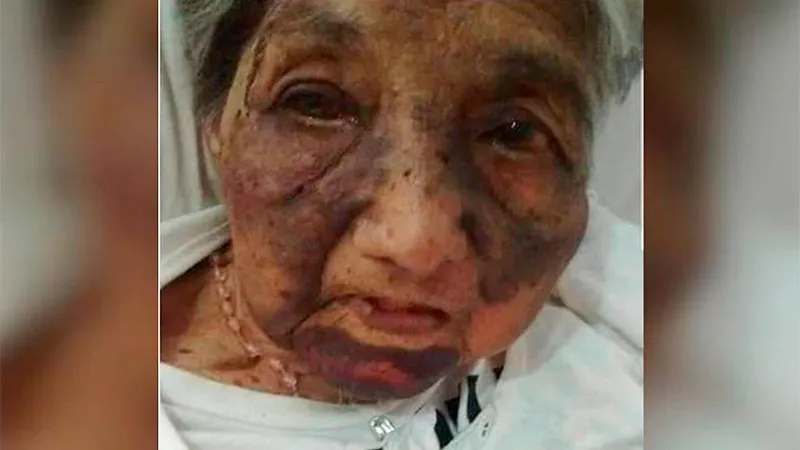 abuela golpeada
