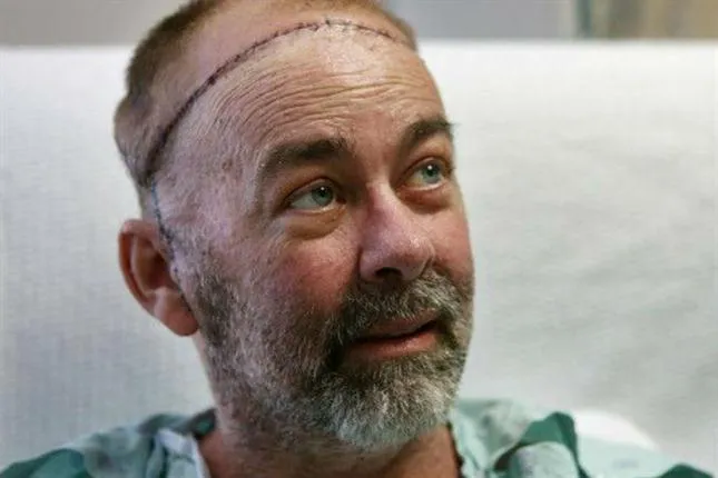 James  leiomiosarcoma