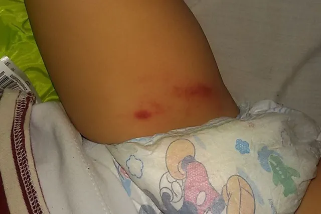 Otra de las fotos con la que Molina denunció a la maestra y al jardín.