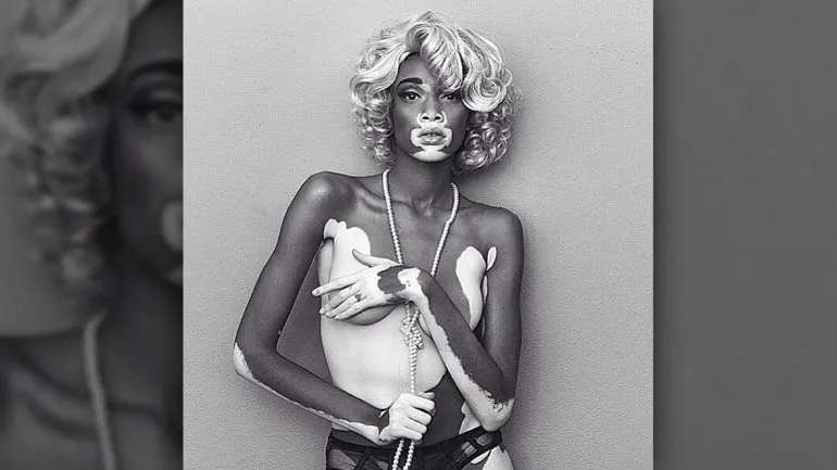 Winnie Harlow 1