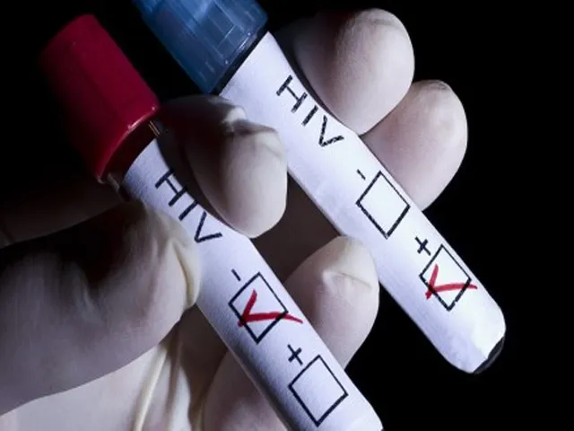 HIV