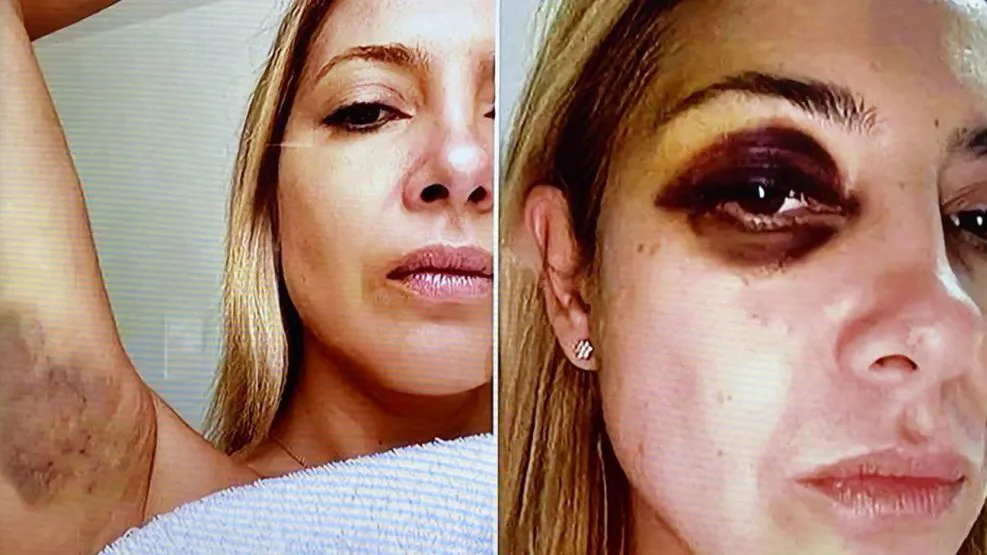 FABIOLA YÁÑEZ GOLPES