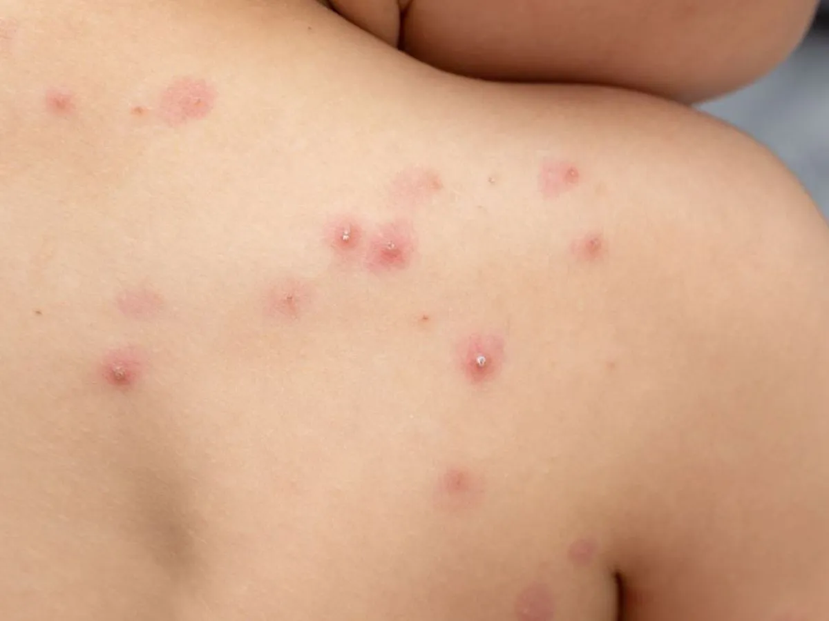 WhatsApp Image 2024-08-16 at 10.01.09