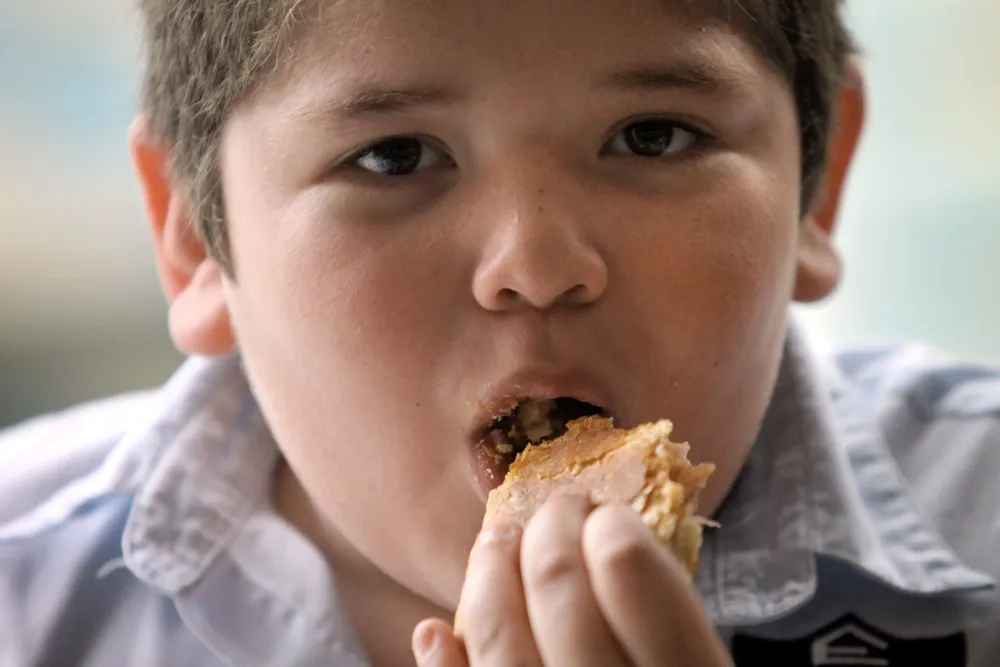 Obesidad
