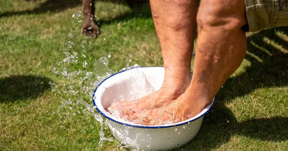 Piernas hinchadas calor verano
