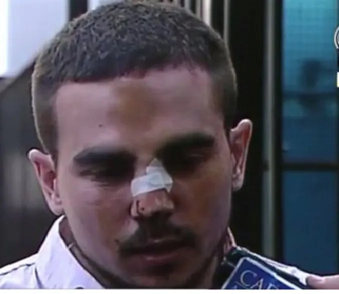 golpeado
