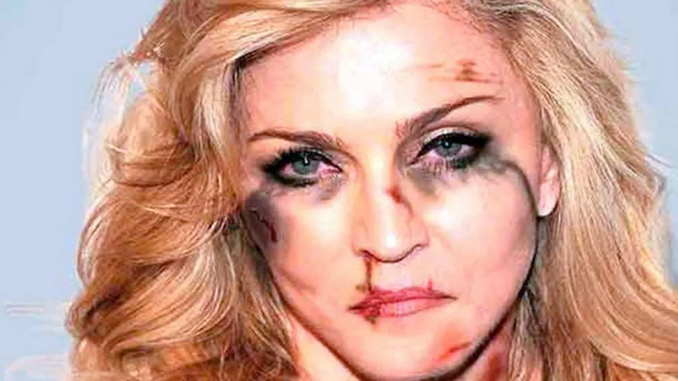 madonna-golpes-campana
