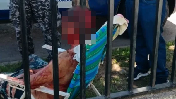 Hombre atacado por un perro