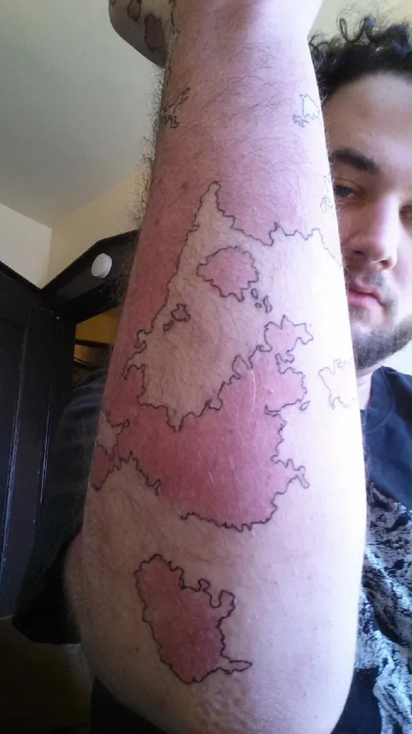 brazo