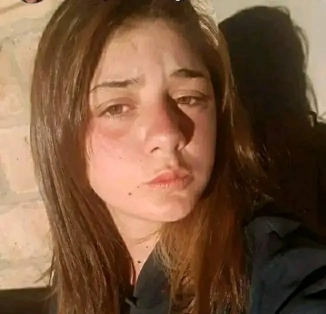 Zoe