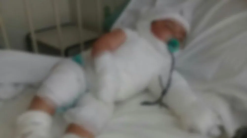 cropped-bebe-quemado