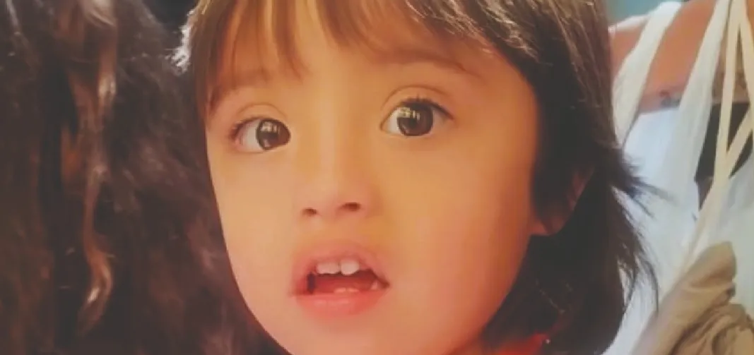 síndrome de down 144pg