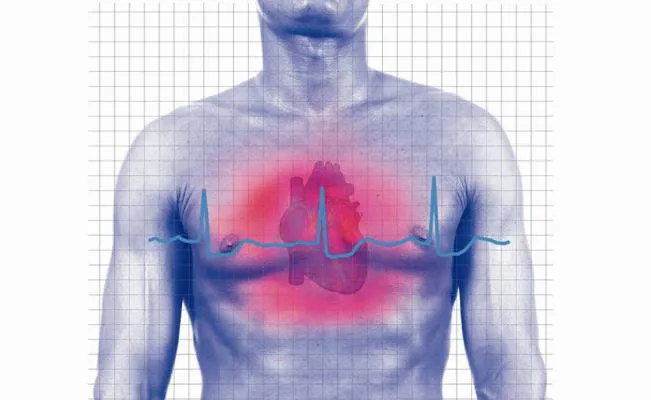 infarto_corazon