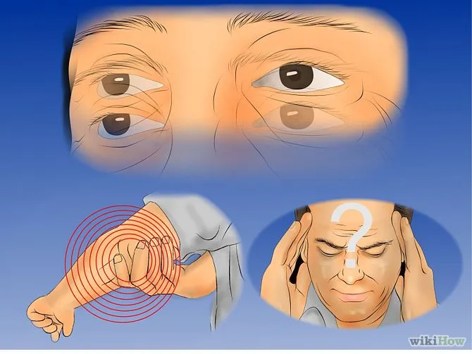 Esclerosis Multiple