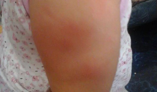 Nena-Mal-Vacunada1-640x375