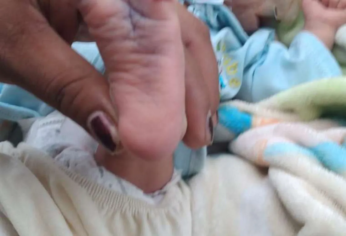 bebe abandonado