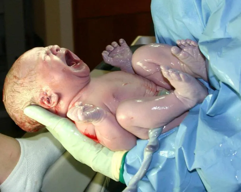 parto bebe