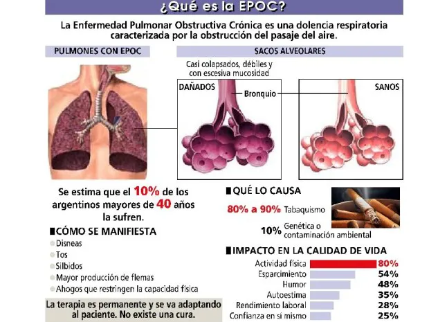 EPOC