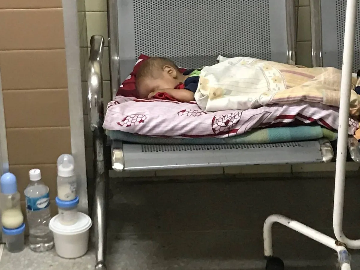 bebé desnutrición 22